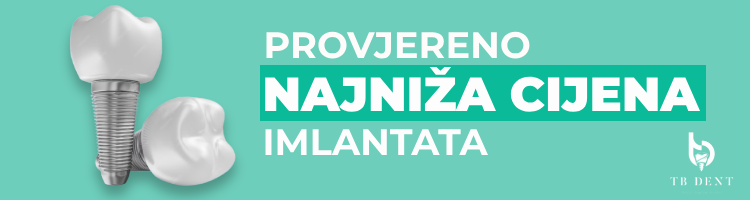 Sve što vas zanima o implantatima 5 zubni implantati cijena trebinje