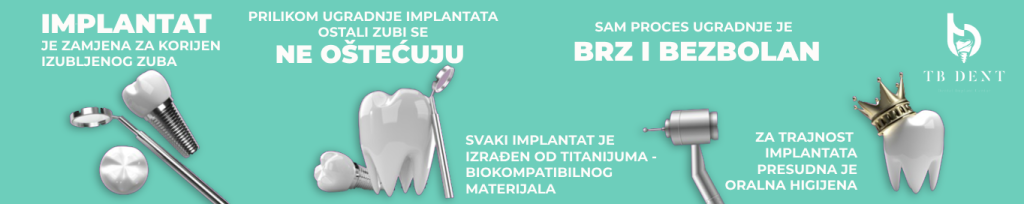 Sve što vas zanima o implantatima 2 zubni implantati trebinje 1024x204 1