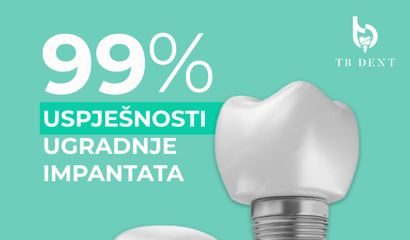 zubni implantati uspjesnost trebinje 1 e1757085154436