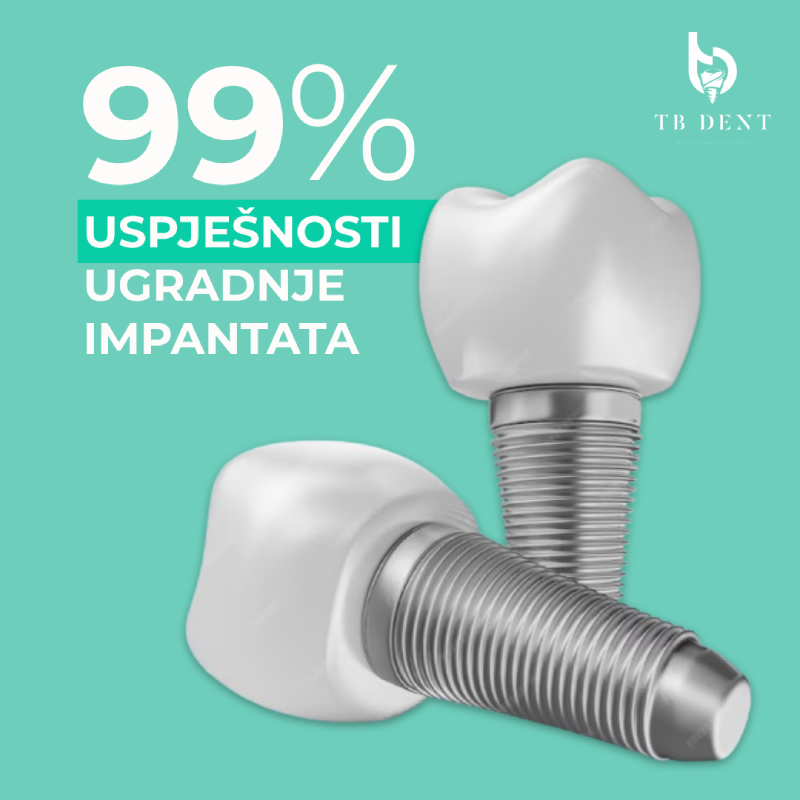 Sve što vas zanima o implantatima 3 zubni implantati uspjesnost trebinje